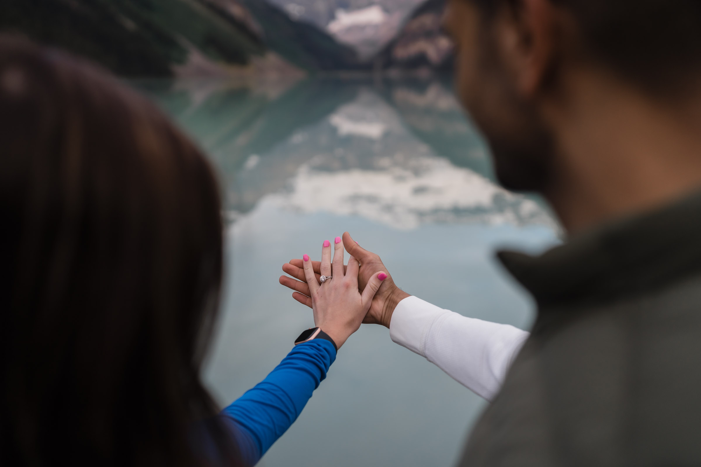 Proposal at Lake Louise in Banff National Park the couple is holding out there hands in front of them to show off the engagement ring.